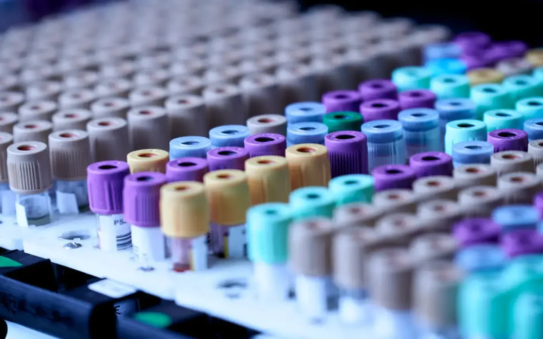El análisis de sangre que está revolucionando la detección del cáncer
